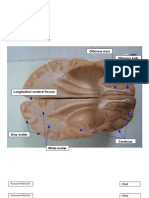 Brain, Cerebrum, Inferior View 041708