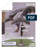 Ventricular System, Right Posterolateral View 042408