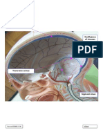 Head Model, Right Skull Cavity, Superoposterolateral032808