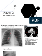 Signos Del Torax Por Rayos X