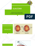 Glaucoma Catarata