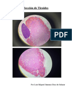 Sección de Tiroides Acabado