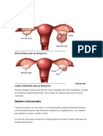 Quistes ováricos: causas y tipos