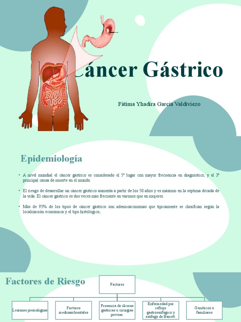 Cancer Gastrico Pdf Cáncer Metástasis