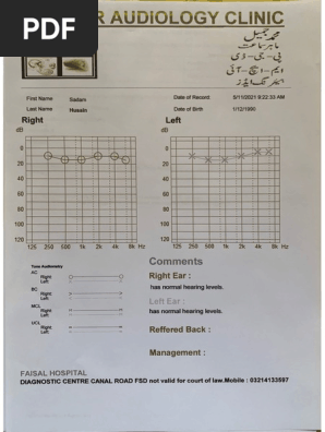 Audiogram 