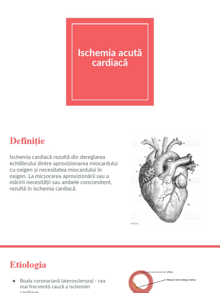 Ischemia Acută Cardiacă PDF