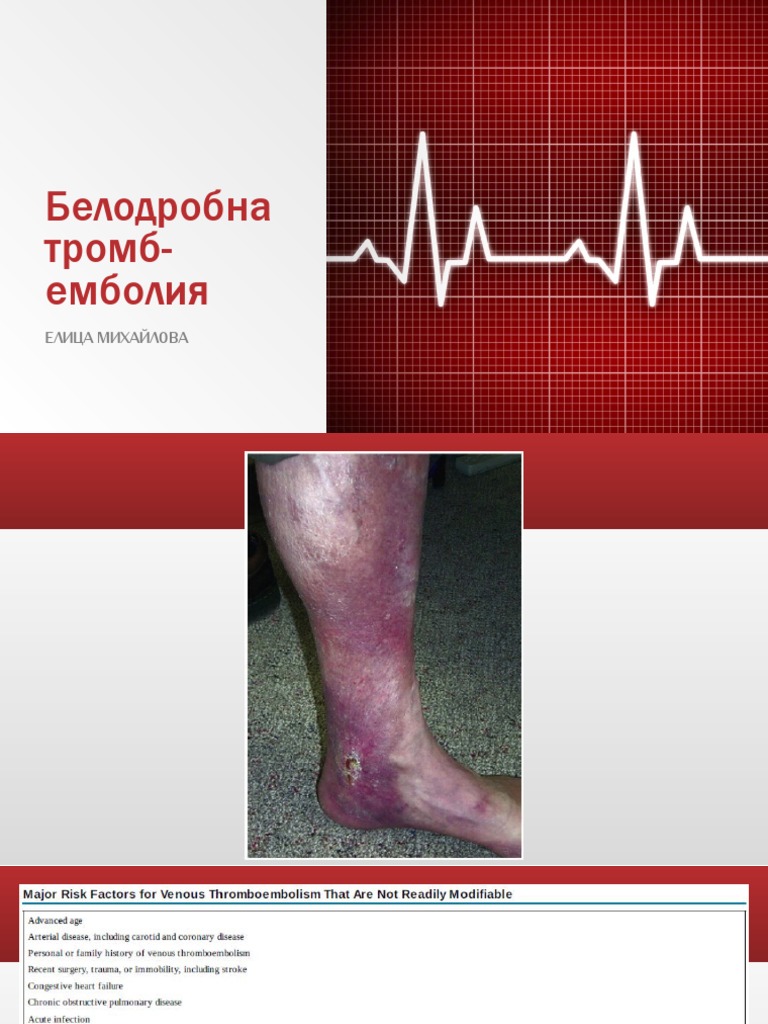 Белодробна тромб-емболия | PDF