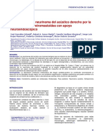 Resección de Un Neurinoma Del Acústico Derecho Por La Vía Suboccipital Retromastoidea Con Apoyo Neuroendoscópico