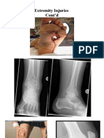 Extremity Injuries 2