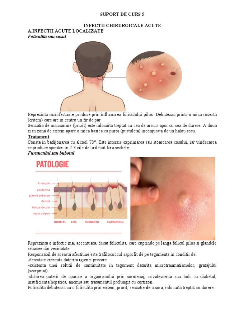 SUPORT DE CURS 5 Infectii-Chirurgicale-Acute | PDF