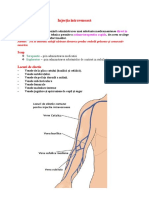 Injecția intravenoasă