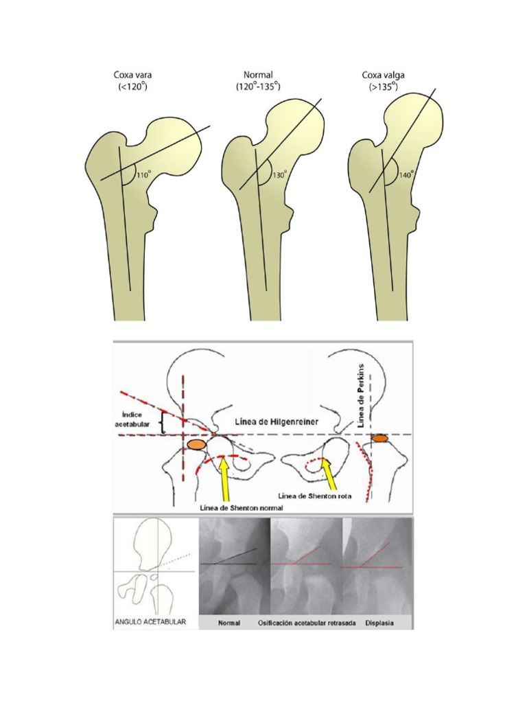 Angulos de Cadera | PDF