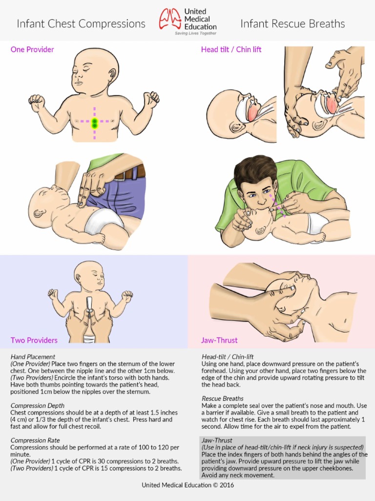Infant Chest Compressions and Rescue Breaths HD | PDF