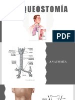 Traqueostomía (4764) 17 09 2022