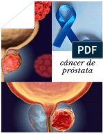 Cancer de Prostata 2