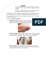 Psoriasis: causas, tipos y tratamiento de la afección cutánea