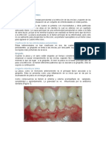 Enfermedades Periodontales