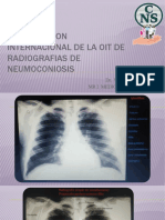 Clasificacion Internacional Radiografias Neumoconiosis