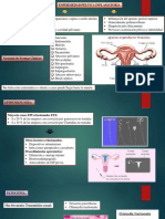 Enfermedad Pelvica Inflamatoria