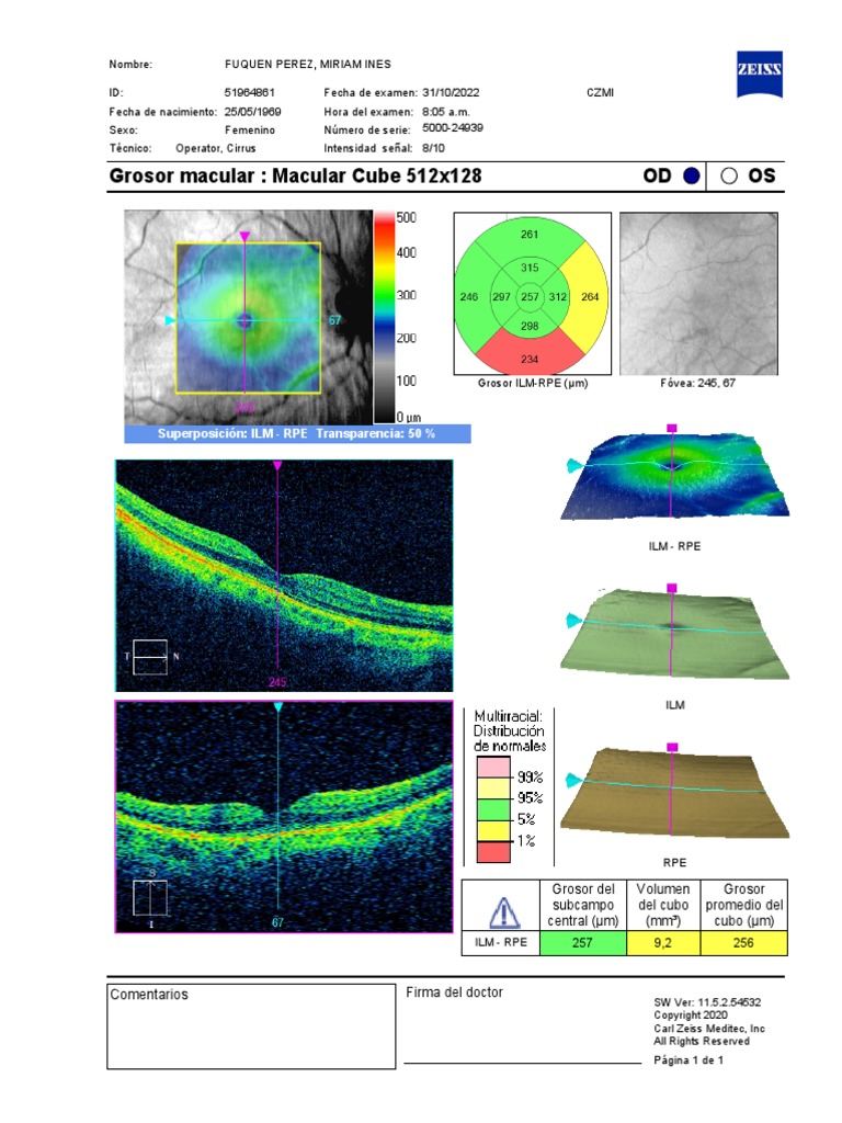 OS OD Grosor Macular: Macular Cube 512x128: Fuquen Perez, Miriam Ines | PDF