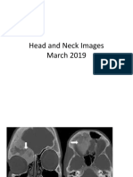 Head and Neck Images