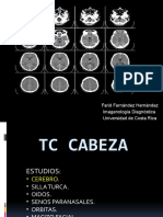 TC Cabeza