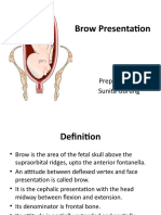 Brow Presentation Diagnosis and Management