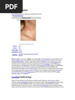 Download Herpes Zoster by Fitri Armanti SN61105464 doc pdf