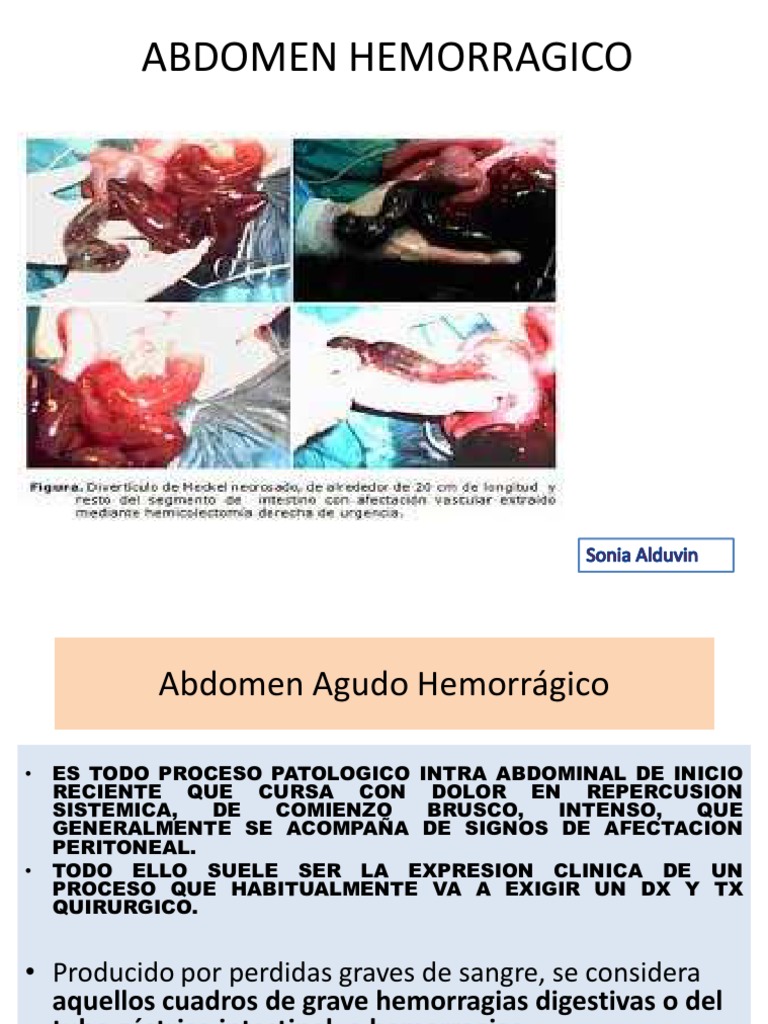 Abdomen Hemorragico | Abdomen | Lesión