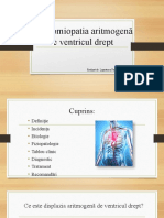 Cardiomiopatia Aritmogenă de Ventricul Drept