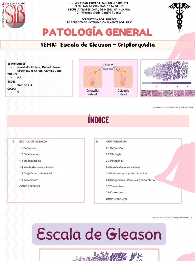 Criptorquidia Escala de Gleason PDF Cancer de prostata