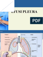 Efusi Pleura