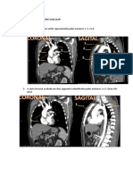 Sistema vascular - artérias principais