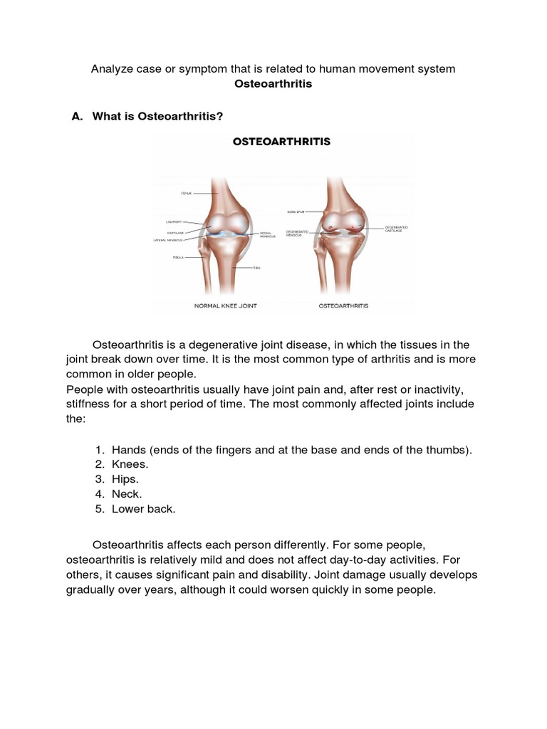 Osteoarthritis Essay Pdf Osteoarthritis Joint