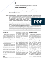 Avaliação de fistula anal por RNM