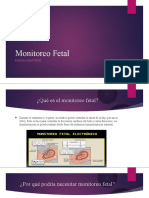 Monitoreo Fetal