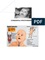 Congenital hypothyroidism and amino acid metabolism disorders in newborns