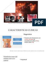 Tormenta Tiroidea Caracteristicas Clinicas 3