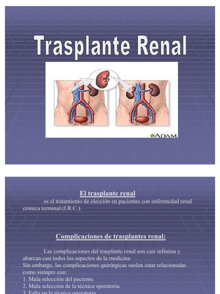 Trasplante Renal PDF Trasplante de riñón Transplante de organo