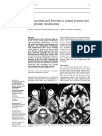 Mielinolisis 2