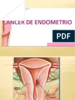 Cáncer Endometrial