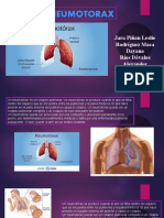 Neumotorax Final