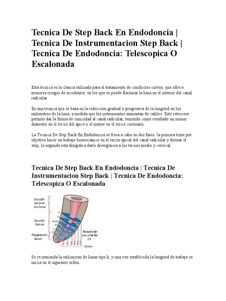 Tecnica de Step Back en Endodoncia PDF