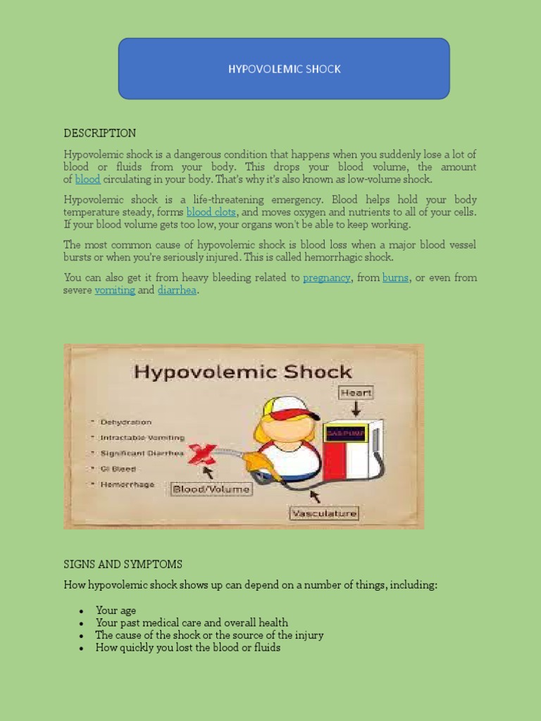 Activity28 (HypovolemicShock) PDF Shock (Circulatory) Bleeding