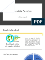 Paralisia Cerebral