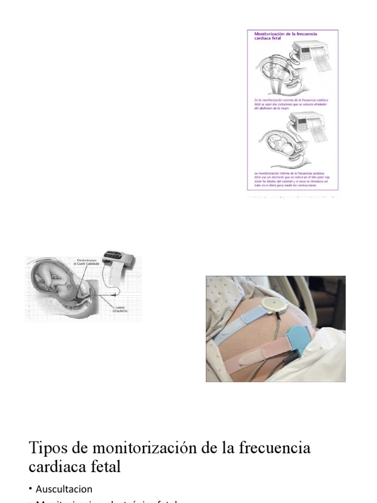 RCTG | PDF | Parto | Especialidades Medicas