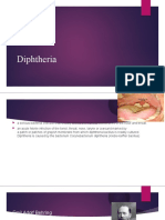 Diphtheria: Bacterial Infection Affecting Throat and Nose