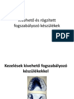 Kivehető És Rögzített Fogszabályozó - 1587629982