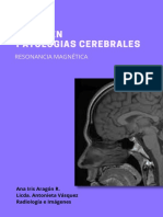 Resumen Patologías Cerebrales - Resonancia Magnética 