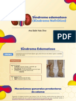 SíndromeEdematosoCausas